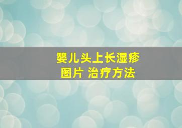 婴儿头上长湿疹图片 治疗方法